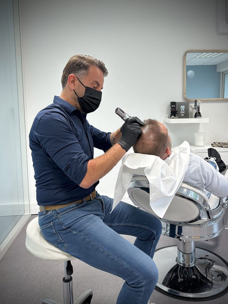 bordeaux-tricopigmentation-01